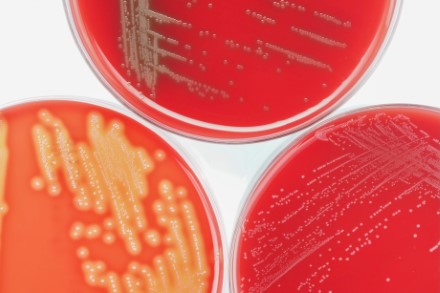 Bild på agarplattor med bakterieodlingar
